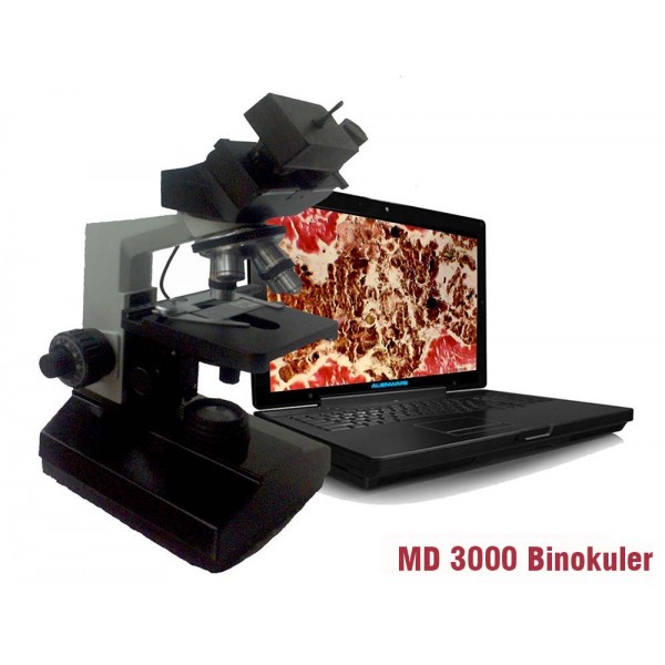 Mikroskop Digital MD 3000 Binokuler